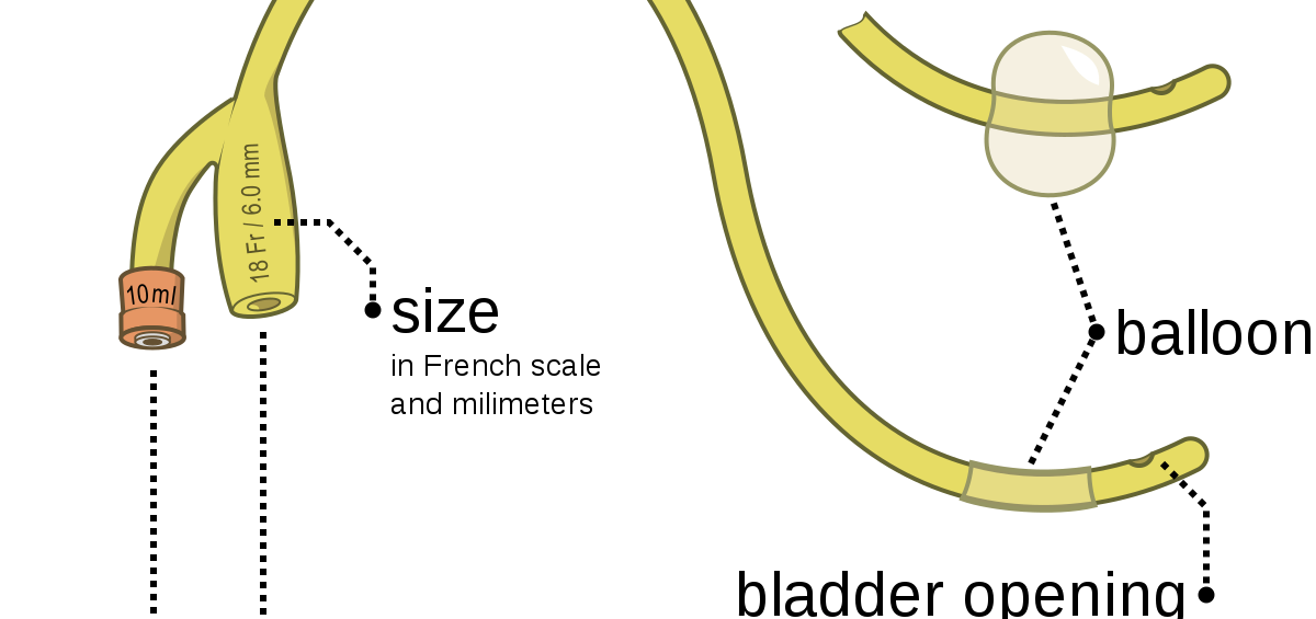 foley-catheter