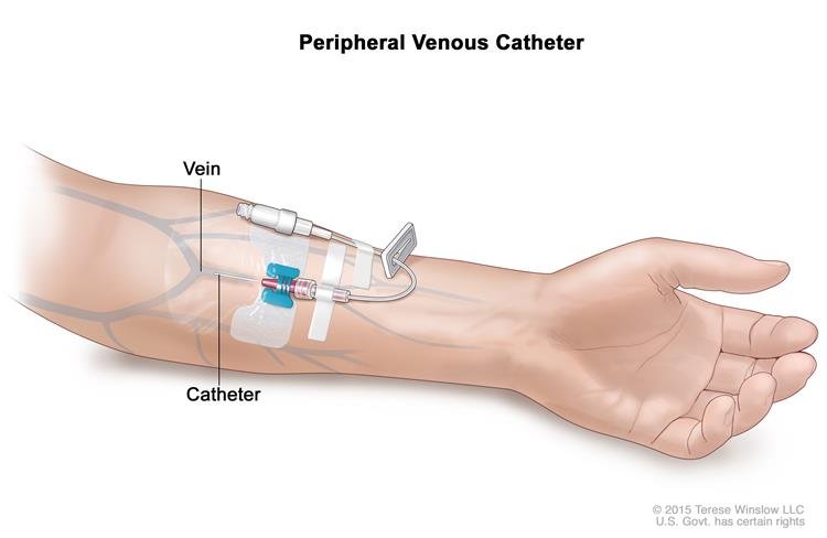 peripheral-catheter-insertion-01 peripheral-catheter-insertion-01