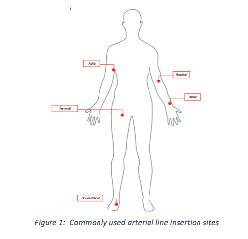 arterial-line-insertion-02