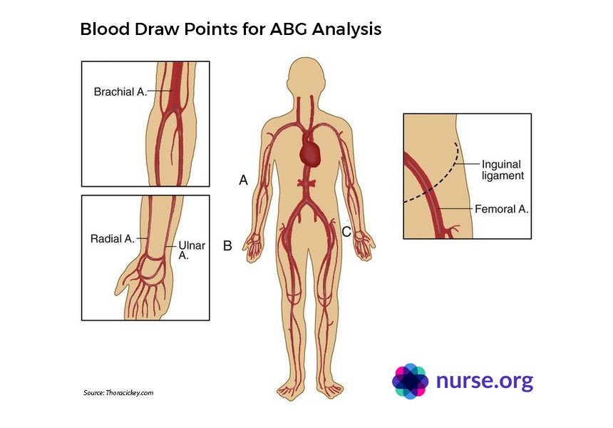 arterial-blood-gas-01 Arterial Blood Gas